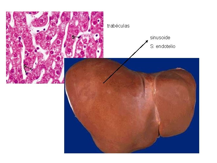 trabéculas sinusoide S: endotelio 