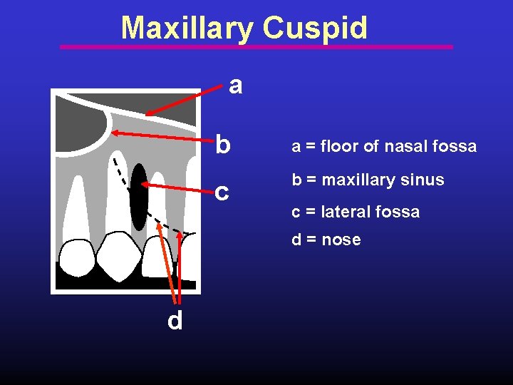 Maxillary Cuspid a b a = floor of nasal fossa c b = maxillary