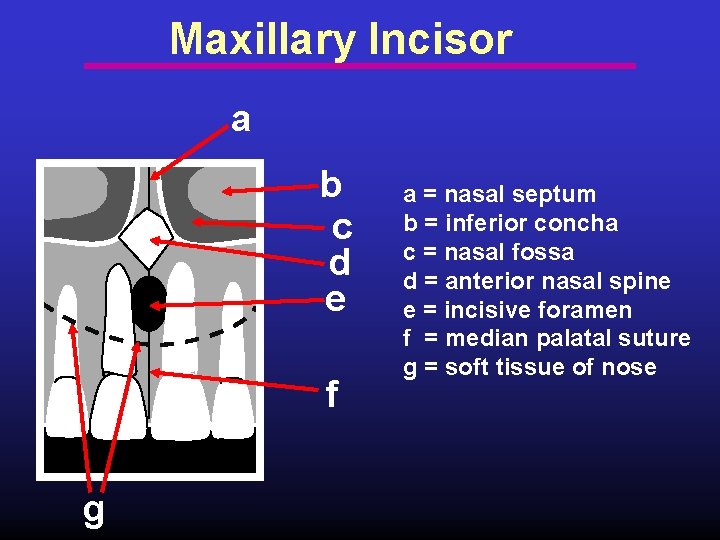 Maxillary Incisor a b c d e f g a = nasal septum b