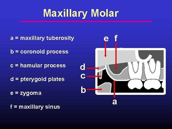 Maxillary Molar e f a = maxillary tuberosity b = coronoid process d =