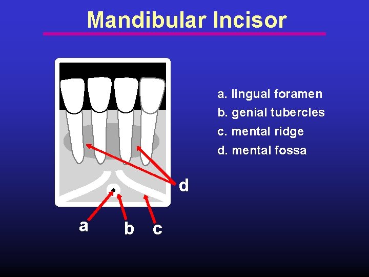 Mandibular Incisor a. lingual foramen b. genial tubercles c. mental ridge d. mental fossa