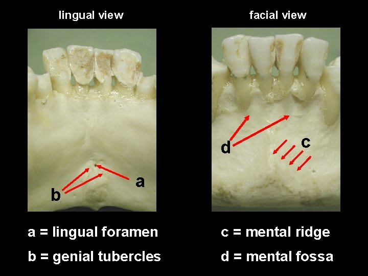 lingual view facial view d b c a a = lingual foramen c =