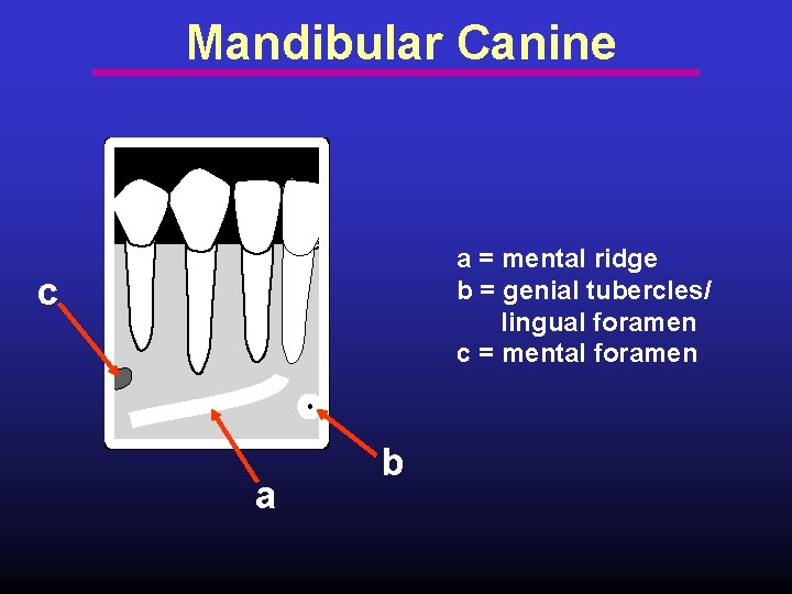 Mandibular Canine a = mental ridge b = genial tubercles/ lingual foramen c =