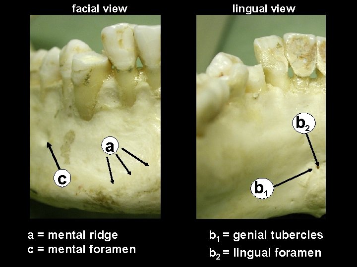 facial view lingual view db 22 b d a d c a = mental