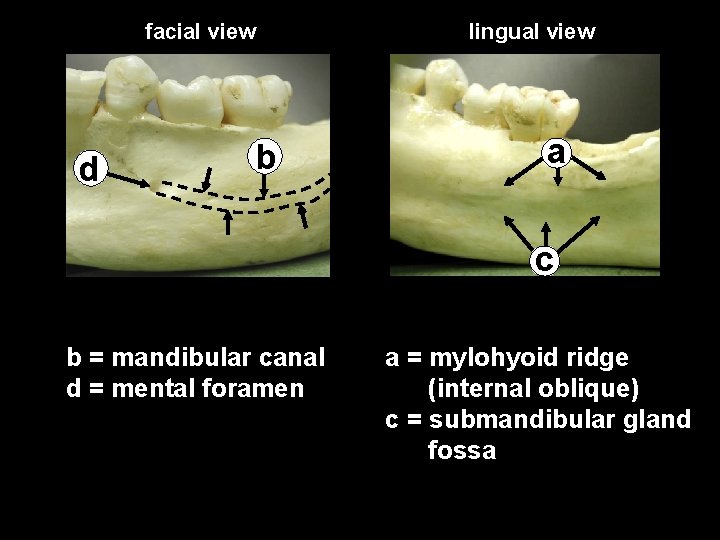 facial view d b lingual view a c b = mandibular canal d =