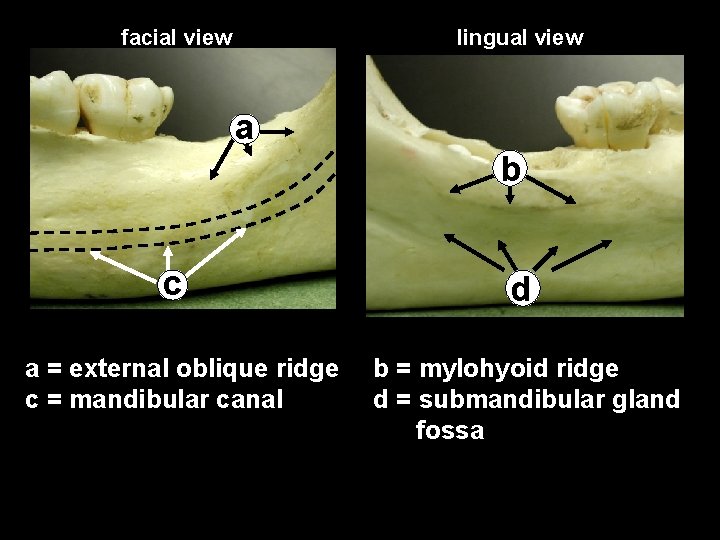 facial view lingual view a b c a = external oblique ridge c =