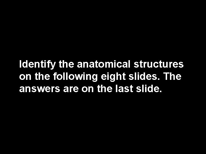 Identify the anatomical structures on the following eight slides. The answers are on the