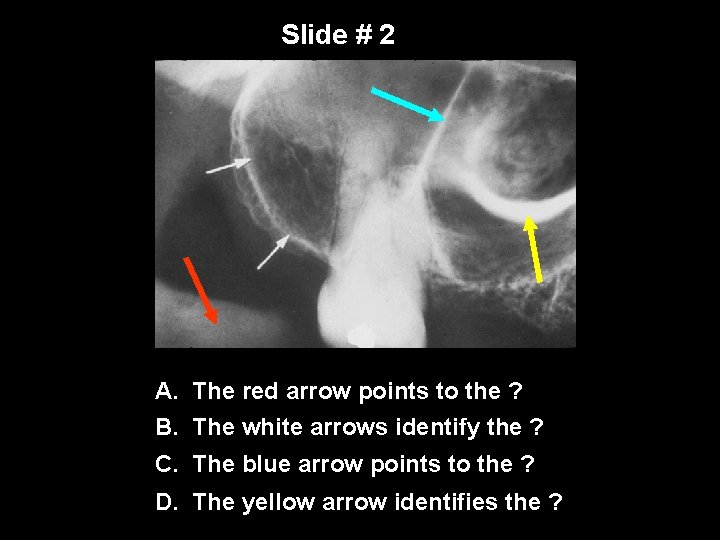 Slide # 2 A. The red arrow points to the ? B. The white