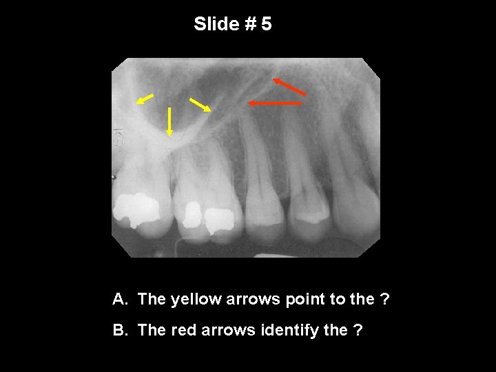Slide # 5 A. The yellow arrows point to the ? B. The red