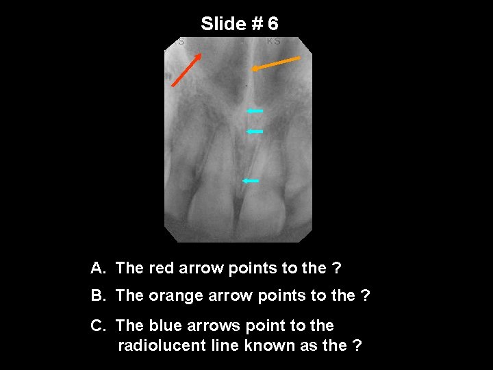 Slide # 6 A. The red arrow points to the ? B. The orange