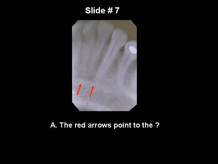 Slide # 7 A. The red arrows point to the ? 