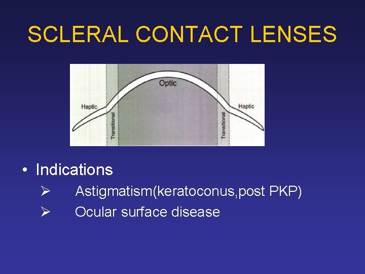 SCLERAL CONTACT LENSES • Indications Ø Ø Astigmatism(keratoconus, post PKP) Ocular surface disease 