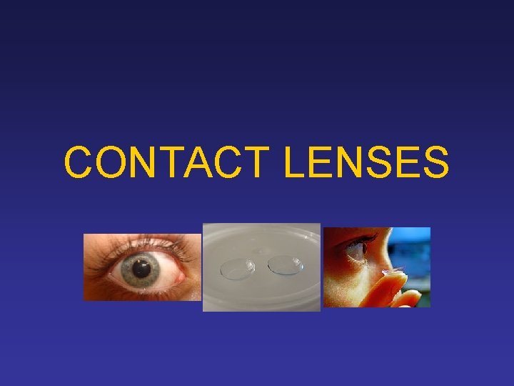 CONTACT LENSES 