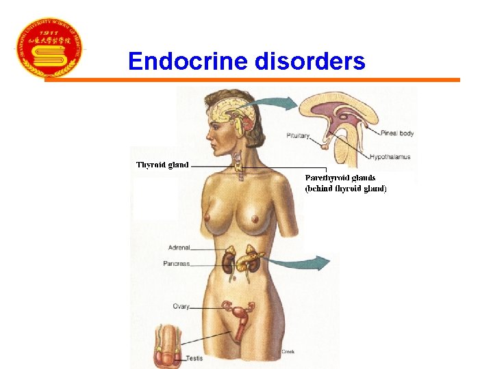 Endocrine disorders 