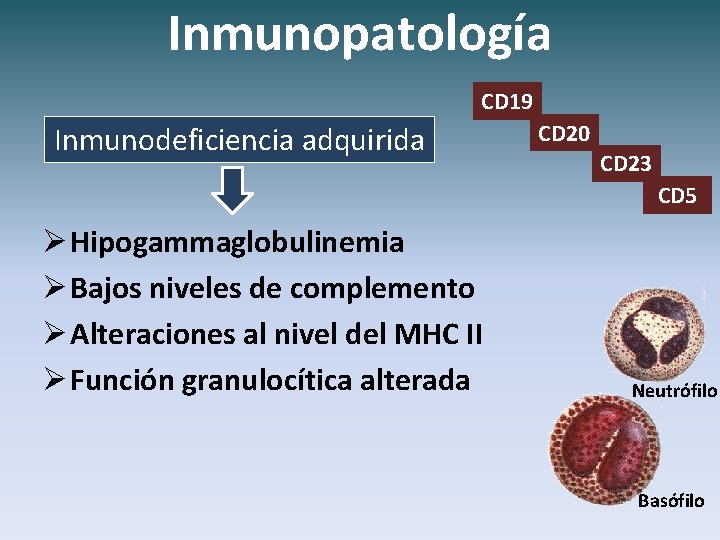 Inmunopatología CD 19 Inmunodeficiencia adquirida CD 20 CD 23 CD 5 Ø Hipogammaglobulinemia Ø