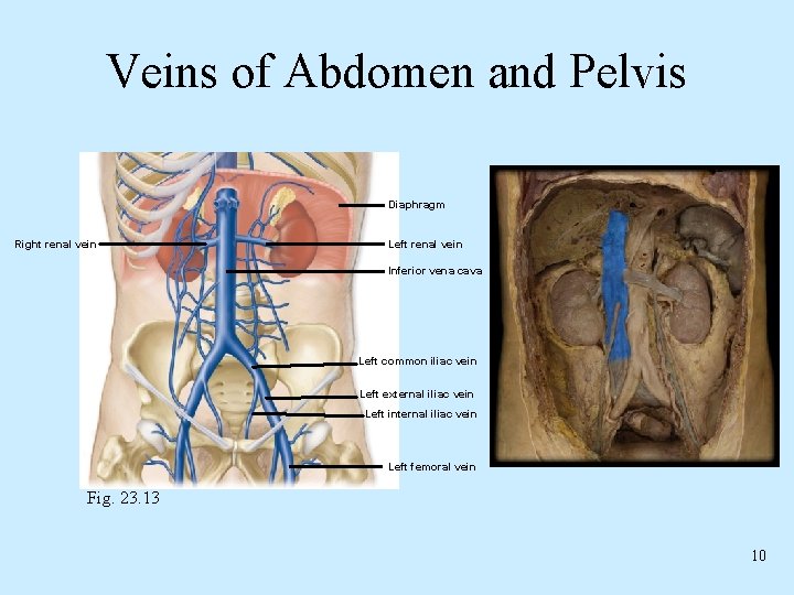 Veins of Abdomen and Pelvis Diaphragm Right renal vein Left renal vein Inferior vena