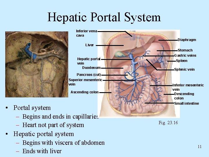 Hepatic Portal System Inferior vena cava Diaphragm Liver Hepatic portal vein Duodenum Stomach Gastric