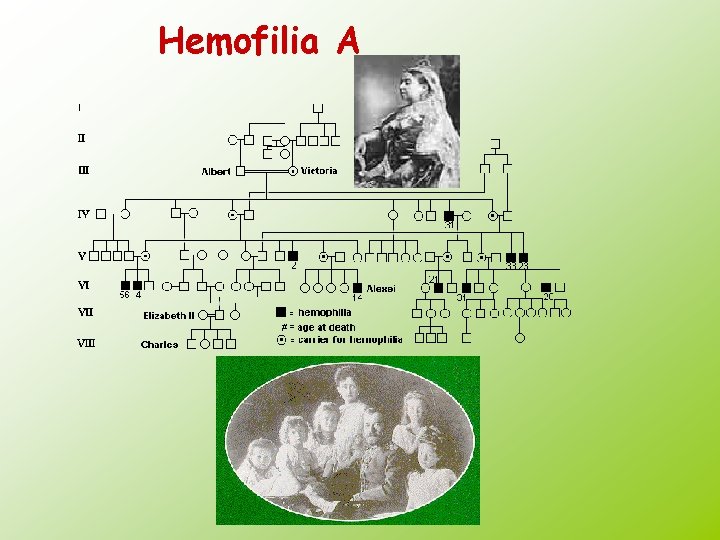 Hemofilia A 