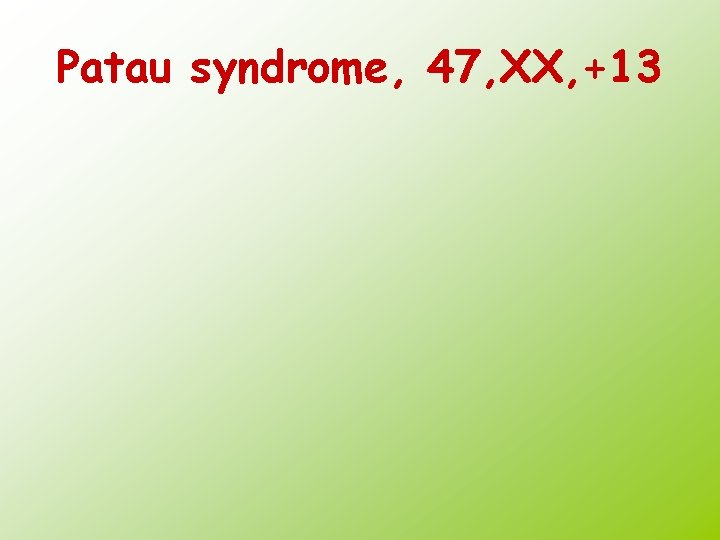 Patau syndrome, 47, XX, +13 