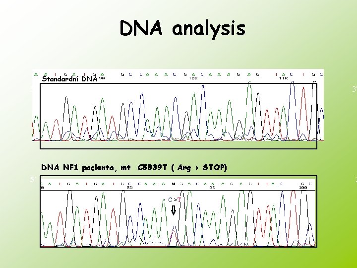 DNA analysis Standardní DNA 5’ 3’ DNA NF 1 pacienta, mt C 5839 T