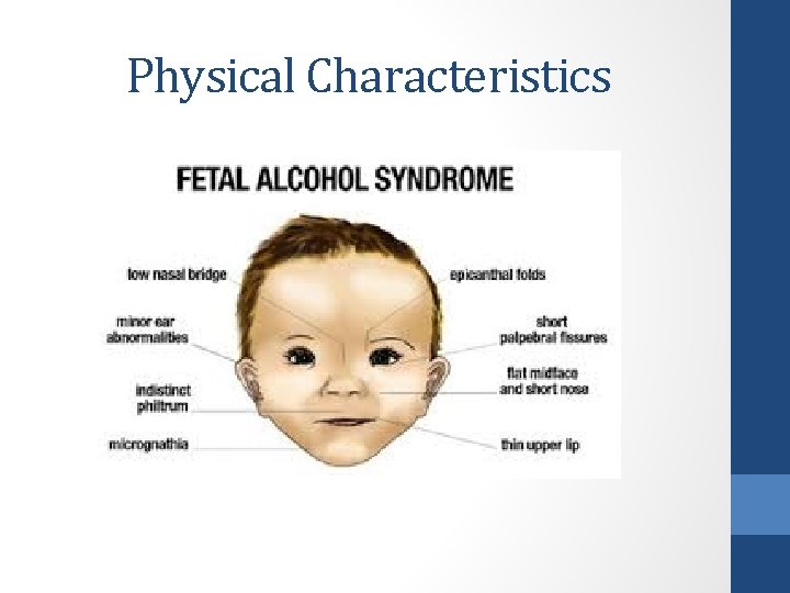 Fetal Alcohol Syndrome What makes Fetal Alcohol Syndrome