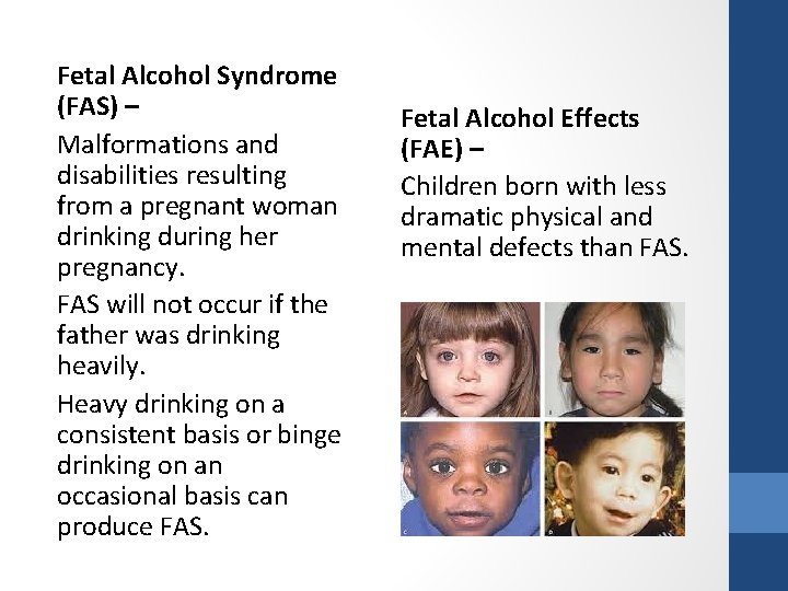 Fetal Alcohol Syndrome (FAS) – Malformations and disabilities resulting from a pregnant woman drinking