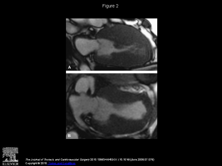 Figure 2 The Journal of Thoracic and Cardiovascular Surgery 2010 139634 -640 DOI: (10.