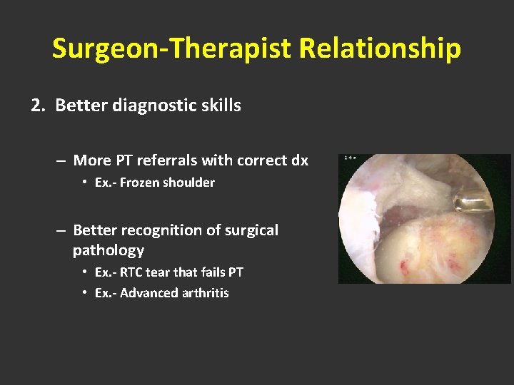 Surgeon-Therapist Relationship 2. Better diagnostic skills – More PT referrals with correct dx •