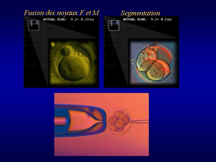 Fusion des noyaux F et M Segmentation 