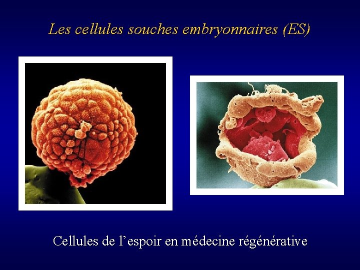 Les cellules souches embryonnaires (ES) Cellules de l’espoir en médecine régénérative 