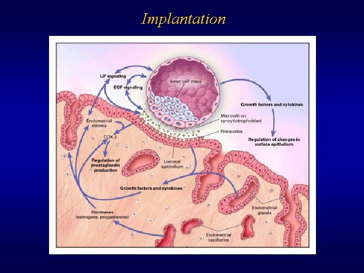 Implantation 