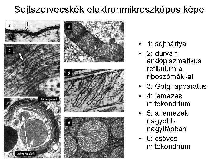 Sejtszervecskék elektronmikroszkópos képe • 1: sejthártya • 2: durva f. endoplazmatikus retikulum a riboszómákkal