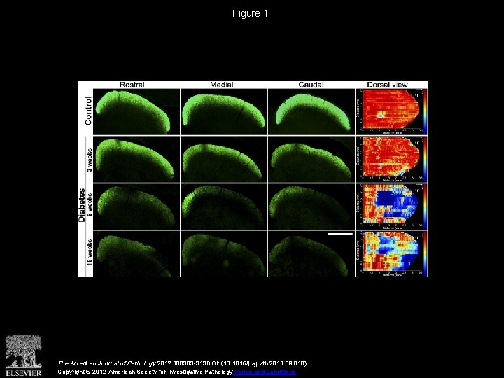Figure 1 The American Journal of Pathology 2012 180303 -313 DOI: (10. 1016/j. ajpath.