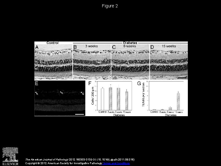 Figure 2 The American Journal of Pathology 2012 180303 -313 DOI: (10. 1016/j. ajpath.
