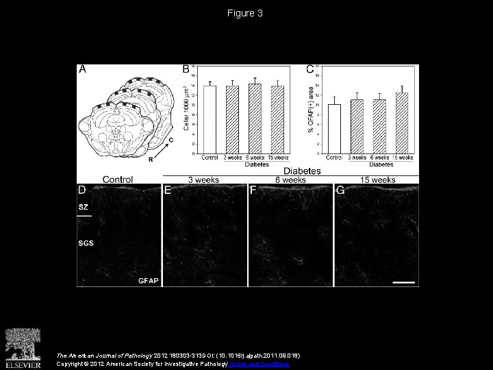 Figure 3 The American Journal of Pathology 2012 180303 -313 DOI: (10. 1016/j. ajpath.