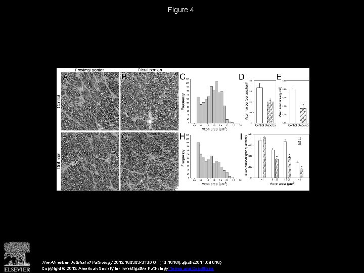 Figure 4 The American Journal of Pathology 2012 180303 -313 DOI: (10. 1016/j. ajpath.