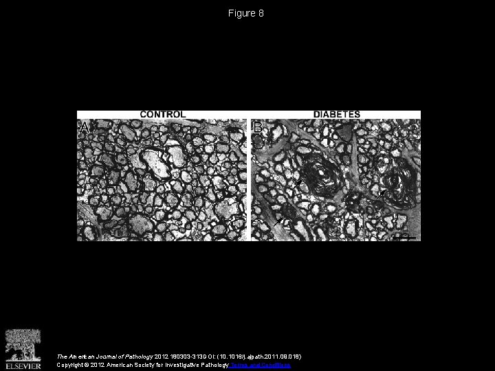 Figure 8 The American Journal of Pathology 2012 180303 -313 DOI: (10. 1016/j. ajpath.