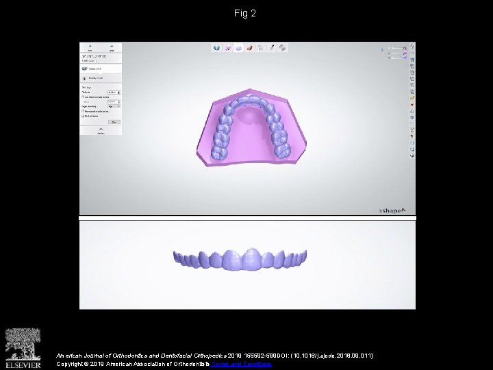 Fig 2 American Journal of Orthodontics and Dentofacial Orthopedics 2019 155592 -599 DOI: (10.