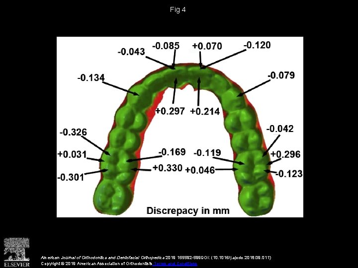 Fig 4 American Journal of Orthodontics and Dentofacial Orthopedics 2019 155592 -599 DOI: (10.