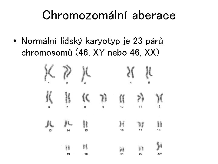 Chromozomální aberace • Normální lidský karyotyp je 23 párů chromosomů (46, XY nebo 46,