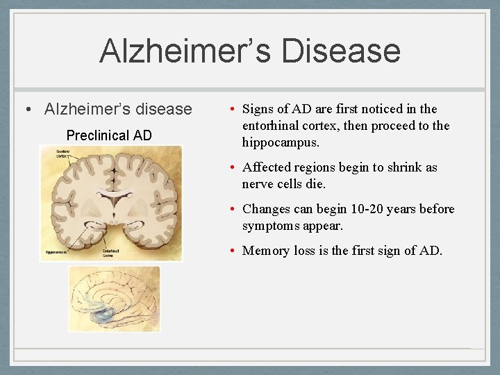 Alzheimer’s Disease • Alzheimer’s disease Preclinical AD • Signs of AD are first noticed