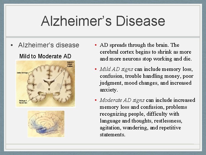 Alzheimer’s Disease • Alzheimer’s disease Mild to Moderate AD • AD spreads through the