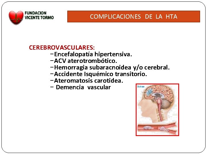 COMPLICACIONES DE LA HTA CEREBROVASCULARES: –Encefalopatía hipertensiva. –ACV aterotrombótico. –Hemorragia subaracnoidea y/o cerebral. –Accidente