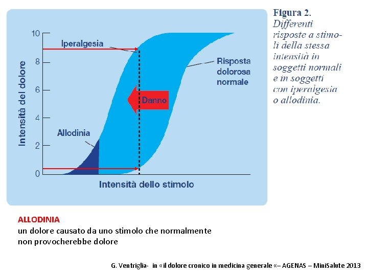 ALLODINIA un dolore causato da uno stimolo che normalmente non provocherebbe dolore G. Ventriglia-