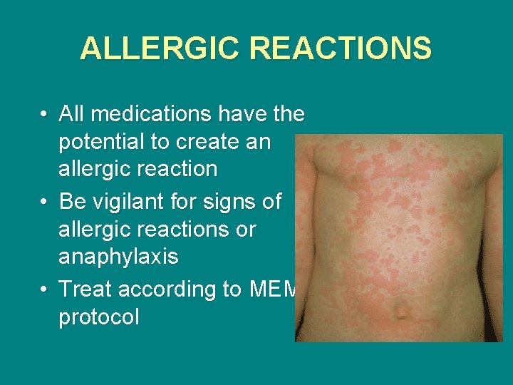 ALLERGIC REACTIONS • All medications have the potential to create an allergic reaction •