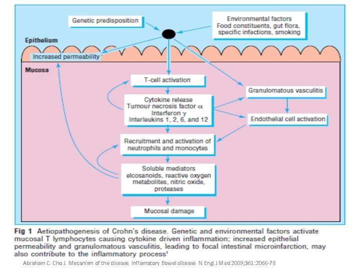 Abraham C. Cho J. Mecanism of the disease. Inflamatory Bowel disease. N Engl J Abraham C. Cho J. Mecanism of the disease. Inflamatory Bowel disease. N Engl J