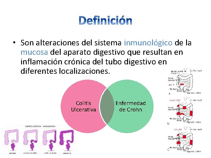 • Son alteraciones del sistema inmunológico de la mucosa del aparato digestivo que • Son alteraciones del sistema inmunológico de la mucosa del aparato digestivo que
