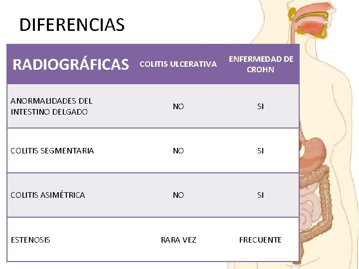 DIFERENCIAS SI ENFERMEDAD DE ENFERMEDAD CROHN DE CROHN OCASIONAL RARA NOVEZ OCASIONAL FRECUENTE SI DIFERENCIAS SI ENFERMEDAD DE ENFERMEDAD CROHN DE CROHN OCASIONAL RARA NOVEZ OCASIONAL FRECUENTE SI