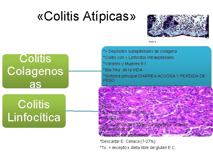 «Colitis Atípicas» Colitis Colagenos as Colitis Linfocítica *> Depósitos subepiteliales de colágena *Colitis «Colitis Atípicas» Colitis Colagenos as Colitis Linfocítica *> Depósitos subepiteliales de colágena *Colitis