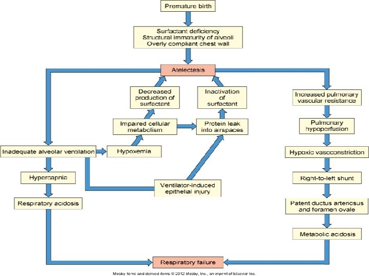 RDS in the Newborn RDS in the Newborn